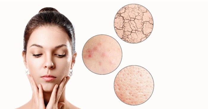 how-to-determine-your-skin-type-02-1024×537 | Aloe Ferox Skin Products